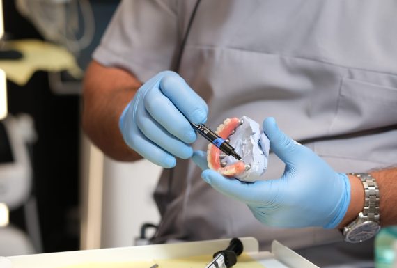 Implantologie Dentară