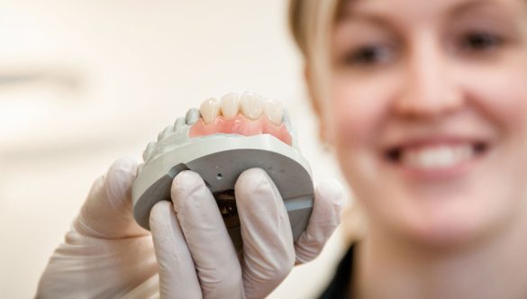 Implant dentar la implant.md: Transparență și calitate în Bălți